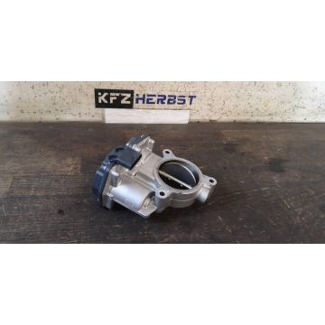Drosselklappe Mercedes E-Klasse W213 6540900070 E220d 1950ccm 143kW 654920